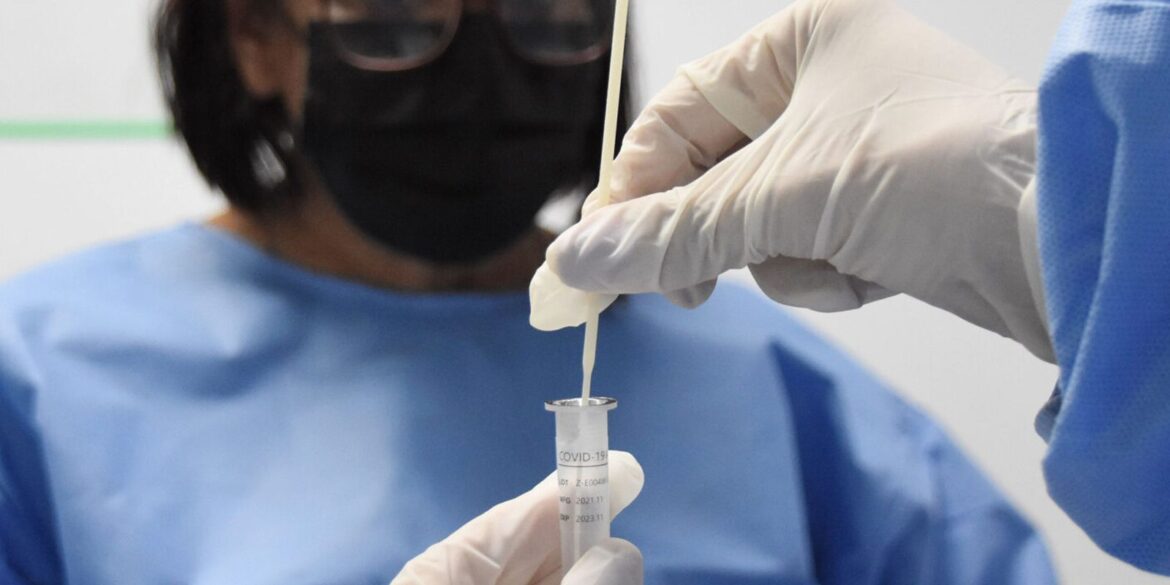 rj:-cenario-epidemiologico-de-covid-19-tem-tendencia-de-reducao