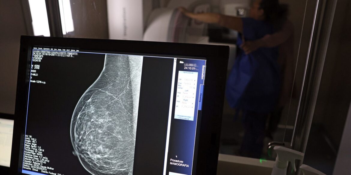 ministerio-da-saude-passa-a-recomendar-mamografia-a-partir-dos-40-anos