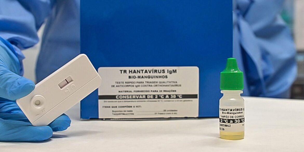 novo-teste-faz-diagnostico-de-hantavirose-em-20-minutos